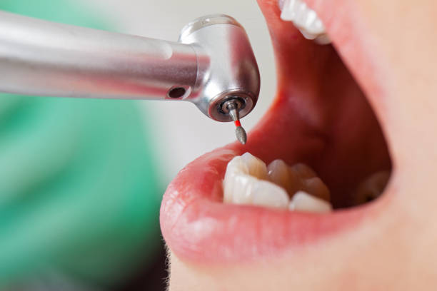 Best Urgent Dental Care for Toothaches in Sanford, NC